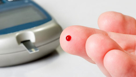 Bubrežni kamenci povezani s rizikom za dijabetes